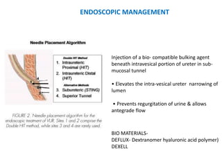 ENDOSCOPIC MANAGEMENT
Injection of a bio- compatible bulking agent
beneath intravesical portion of ureter in sub-
mucosal tunnel
• Elevates the intra-vesical ureter narrowing of
lumen
• Prevents regurgitation of urine & allows
antegrade flow
BIO MATERIALS-
DEFLUX- Dextranomer hyaluronic acid polymer)
DEXELL
 