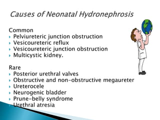 Common
 Pelviureteric junction obstruction
 Vesicoureteric reflux
 Vesicoureteric junction obstruction
 Multicystic kidney.
Rare
 Posterior urethral valves
 Obstructive and non-obstructive megaureter
 Ureterocele
 Neurogenic bladder
 Prune-belly syndrome
 Urethral atresia
 
