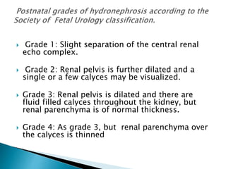  Grade 1: Slight separation of the central renal
echo complex.
 Grade 2: Renal pelvis is further dilated and a
single or a few calyces may be visualized.
 Grade 3: Renal pelvis is dilated and there are
fluid filled calyces throughout the kidney, but
renal parenchyma is of normal thickness.
 Grade 4: As grade 3, but renal parenchyma over
the calyces is thinned
 