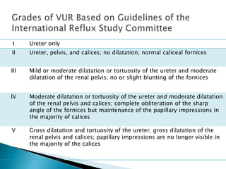 I Ureter only
II Ureter, pelvis, and calices; no dilatation; normal caliceal fornices
III Mild or moderate dilatation or tortuosity of the ureter and moderate
dilatation of the renal pelvis; no or slight blunting of the fornices
IV Moderate dilatation or tortuosity of the ureter and moderate dilatation
of the renal pelvis and calices; complete obliteration of the sharp
angle of the fornices but maintenance of the papillary impressions in
the majority of calices
V Gross dilatation and tortuosity of the ureter; gross dilatation of the
renal pelvis and calices; papillary impressions are no longer visible in
the majority of the calices
 