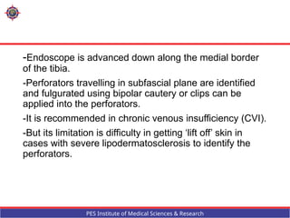 Fulgurated Management of varicose veins for general surgeons | PPTX