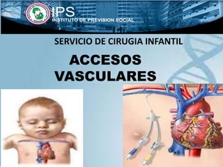 ACCESOS
VASCULARES
SERVICIO DE CIRUGIA INFANTIL
 