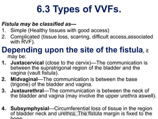 VVF and RVF BY MWEBAZA VICTOR 2022 OBGYN.pptx