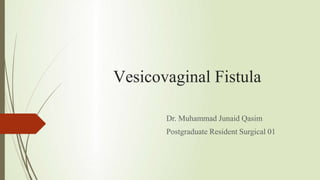 Vesicovaginal Fistula
Dr. Muhammad Junaid Qasim
Postgraduate Resident Surgical 01
 