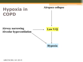 Airspace collapse
Low V/Q
Hypoxia
Airway narrowing
Alveolar hypoventilation
Hypoxia in
COPD
AJRCCM 2001; 163: 283-91
 