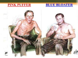 PINK PUFFER BLUE BLOATER
 