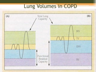 Lung Volumes in COPD
 