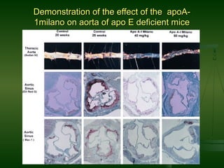 Demonstration of the effect of the apoA-Demonstration of the effect of the apoA-
1milano on aorta of apo E deficient mice1milano on aorta of apo E deficient mice
 