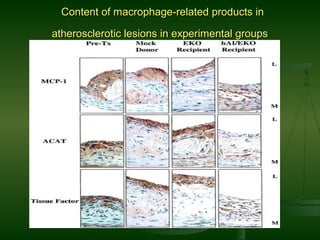 Content of macrophage-related products inContent of macrophage-related products in
atherosclerotic lesions in experimental groupsatherosclerotic lesions in experimental groups
 
