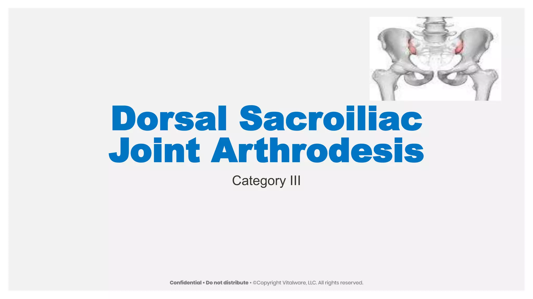 Dorsal Sacroiliac
Joint Arthrodesis
Category III
 