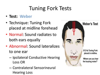 Tuning Fork Tests
• Test: Weber
• Technique: Tuning Fork
placed at midline forehead
• Normal: Sound radiates to
both ears equally
• Abnormal: Sound lateralizes
to one ear
– Ipsilateral Conductive Hearing
Loss OR
– Contralateral Sensorineural
Hearing Loss
 