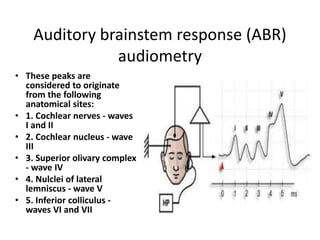 Auditory brainstem response (ABR)
audiometry
• These peaks are
considered to originate
from the following
anatomical sites:
• 1. Cochlear nerves - waves
I and II
• 2. Cochlear nucleus - wave
III
• 3. Superior olivary complex
- wave IV
• 4. Nulclei of lateral
lemniscus - wave V
• 5. Inferior colliculus -
waves VI and VII
 