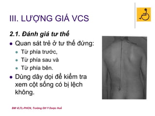BM VLTL-PHCN, Trường DH Y Dược Huế
III. LƯỢNG GIÁ VCS
2.1. Đánh giá tư thế
 Quan sát trẻ ở tư thế đứng:
 Từ phía trước,
 Từ phía sau và
 Từ phía bên.
 Dùng dây dọi để kiểm tra
xem cột sống có bị lệch
không.
 