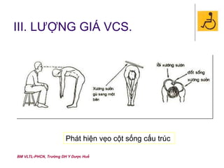 BM VLTL-PHCN, Trường DH Y Dược Huế
III. LƯỢNG GIÁ VCS.
Phát hiện vẹo cột sống cấu trúc
 