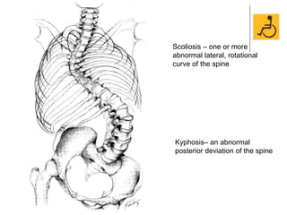 Scoliosis – one or more
abnormal lateral, rotational
curve of the spine
Kyphosis– an abnormal
posterior deviation of the spine
 