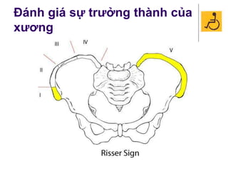 Đánh giá sự trưởng thành của
xương
 