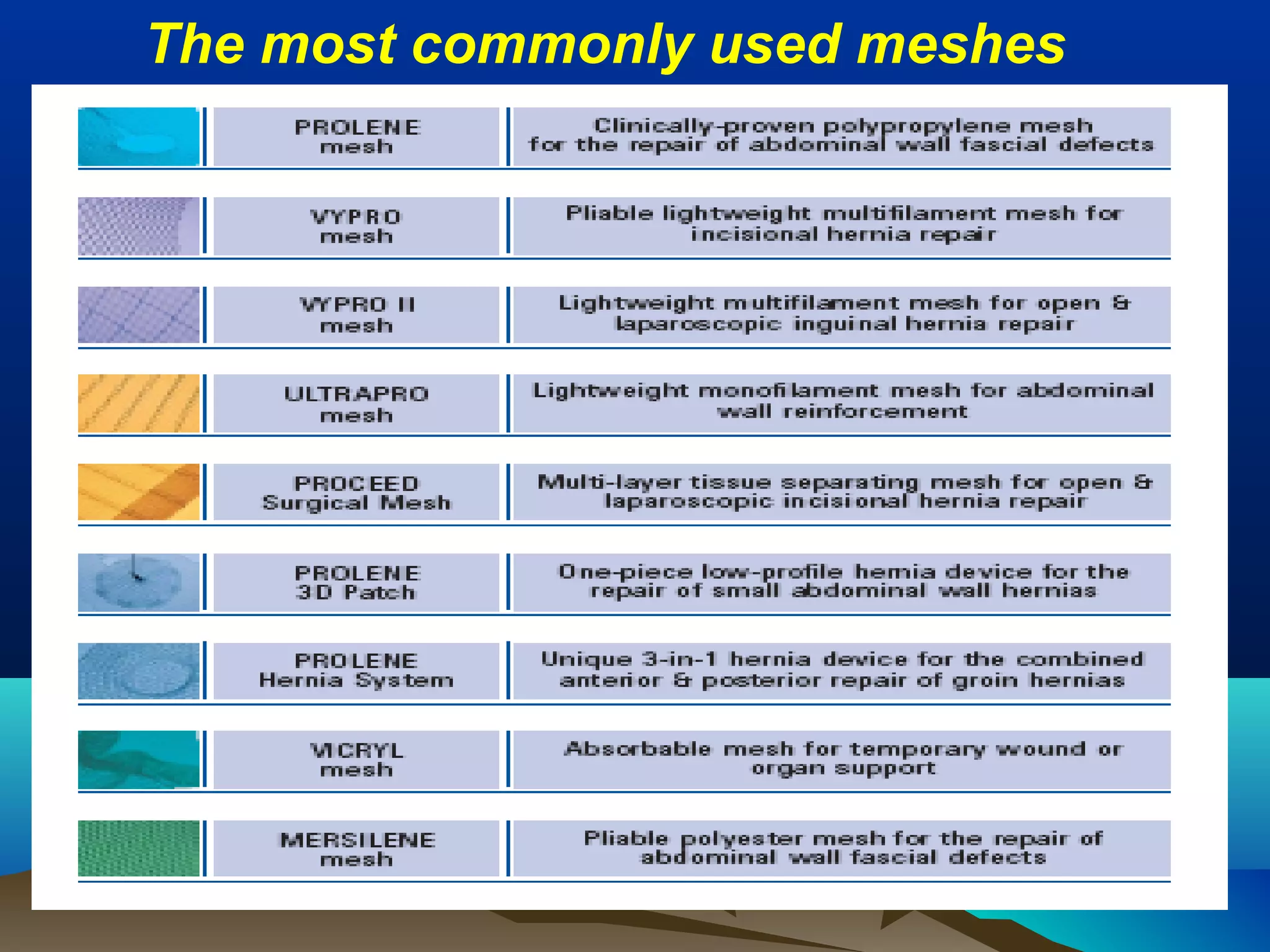 The most commonly used meshes
 