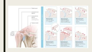 Upper Extremities injury. .pptx