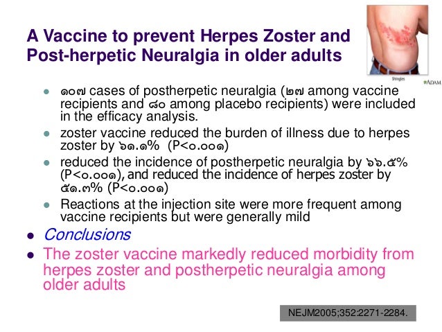 Varicella zoster virus