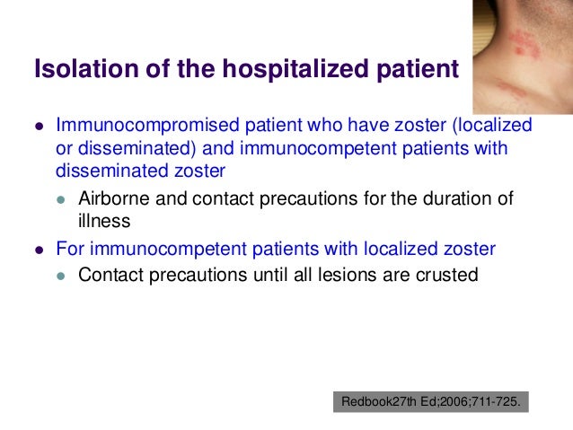 Kawasaki Disease Contact Precautions Kawasaki Disease Contact Precautions