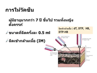 การให้วัคซีน
 ผู้มีอายุมากกว่า 7 ปี ขึ้นไป รวมทั้งหญิง
ตั้งครรภ์
ขนาดที่ฉีดครั้งละ 0.5 ml
ฉีดเข้ากล้ามเนื้อ (IM)
ฉีดเข้ากล้ามเนื้อ : dT, DTP, HB,
DTP-HB
 