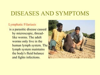 DISEASES AND SYMPTOMS 
Lymphatic Filariasis 
is a parasitic disease caused 
by microscopic, thread-like 
worms. The adult 
worms only live in the 
human lymph system. The 
lymph system maintains 
the body's fluid balance 
and fights infections. 
 