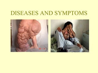 DISEASES AND SYMPTOMS 
 