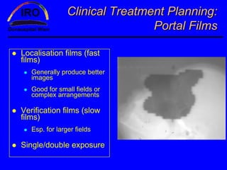 Clinical Treatment Planning:
                                Portal Films

Localisation films (fast
films)
   Generally produce better
   images
   Good for small fields or
   complex arrangements

Verification films (slow
films)
   Esp. for larger fields

Single/double exposure
 