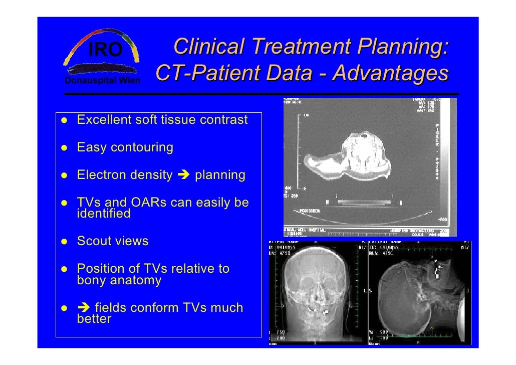 planning systems in radiotherapy