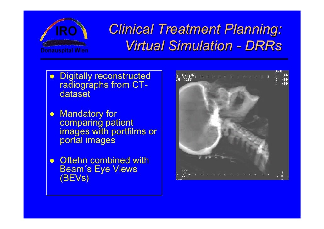 planning systems in radiotherapy
