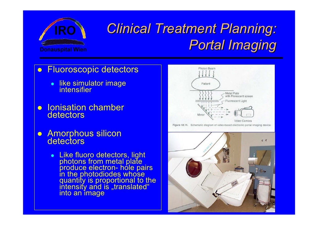planning systems in radiotherapy