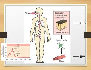 OPV
IPV
 