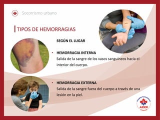 TIPOS DE HEMORRAGIAS
SEGÚN EL LUGAR
• HEMORRAGIA INTERNA
Salida de la sangre de los vasos sanguíneos hacia el
interior del cuerpo.
• HEMORRAGIA EXTERNA
Salida de la sangre fuera del cuerpo a través de una
lesión en la piel.
 