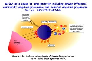 MRSA as a cause of lung infection including airway infection, community-acquired pneumonia and hospital-acquired pneumonia  Defres   ERJ 2009:34:1470  Some of the virulence determinants of  Staphylococcus aureus .  TSST: toxic shock syndrome toxin.  