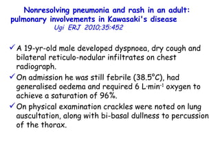 Nonresolving pneumonia and rash in an adult: pulmonary involvements in Kawasaki's disease   Ugi  ERJ  2010;35:452  A 19-yr-old male developed dyspnoea, dry cough and bilateral reticulo-nodular infiltrates on chest radiograph.  On admission he was still febrile (38.5°C), had generalised oedema and required 6 L·min –1  oxygen to achieve a saturation of 96%. On physical examination crackles were noted on lung auscultation, along with bi-basal dullness to percussion of the thorax.  