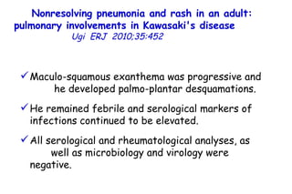 Nonresolving pneumonia and rash in an adult: pulmonary involvements in Kawasaki's disease   Ugi  ERJ  2010;35:452  Maculo-squamous exanthema was progressive and  he developed palmo-plantar desquamations.  He remained febrile and serological markers of infections continued to be elevated.  All serological and rheumatological analyses, as  well as microbiology and virology were negative.  