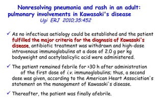 Nonresolving pneumonia and rash in an adult: pulmonary involvements in Kawasaki's disease   Ugi  ERJ  2010;35:452  As no infectious aetiology could be established and the patient  fulfilled the major criteria for the diagnosis of Kawasaki's disease , antibiotic treatment was withdrawn and high-dose intravenous immunoglobulins at a dose of 2.0 g per kg bodyweight and acetylsalicylic acid were administered.  The patient remained febrile for >30 h after administration  of the first dose of  i.v.  immunoglobulins; thus, a second dose was given, according to the American Heart Association's statement on the management of Kawasaki's disease.  Thereafter, the patient was finally afebrile.  