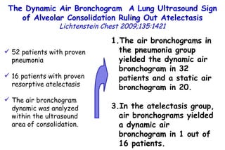 The Dynamic Air Bronchogram  A Lung Ultrasound Sign of Alveolar Consolidation  Ruling Out Atelectasis Lichtenstein Chest 2009;135:1421 52 patients with proven pneumonia 16 patients with proven resorptive atelectasis The air bronchogram dynamic was analyzed within the ultrasound area of consolidation. The air bronchograms in the pneumonia group yielded the dynamic air bronchogram in 32 patients and a static air bronchogram in 20. In the atelectasis group, air bronchograms yielded a dynamic air bronchogram in 1 out of 16 patients. 