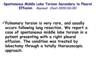 Spontaneous Middle Lobe Torsion Secondary to Pleural Effusion  Raynaud  Chest 2009;136:281 Pulmonary torsion is very rare, and usually occurs following lung resection. We report a case of spontaneous middle lobe torsion in a patient presenting with a right pleural effusion. The condition was treated by lobectomy through a totally thoracoscopic approach. 