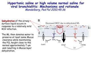 Hypertonic saline or high volume normal saline for viral bronchiolitis: Mechanisms and rationale   Mandelberg,   Ped Pul 2010;45:36 Dehydration  of the airway  surface liquid occurs in  response to a relatively mild RSV infection. The ML then donates water to preserve at least some Mucus  clearance while maintaining the PCL height close to the  normal approximately 7  ц m and resulting in Mucus layer  dehydration. H 2 O 