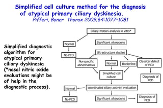 Simplified diagnostic algorithm for atypical primary ciliary dyskinesia (*nasal nitric oxide evaluations might be of help in the diagnostic process). Simplified cell culture method for the diagnosis of atypical primary ciliary dyskinesia.  Pifferi, Boner  Thorax 2009;64:1077–1081 