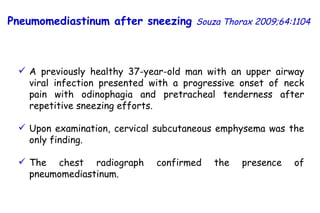 A previously healthy 37-year-old man with an upper airway viral infection presented with a progressive onset of neck pain with odinophagia and pretracheal tenderness after repetitive sneezing efforts.  Upon examination, cervical subcutaneous emphysema was the only finding.  The chest radiograph confirmed the presence of pneumomediastinum.   Pneumomediastinum after sneezing   Souza Thorax 2009;64:1104 