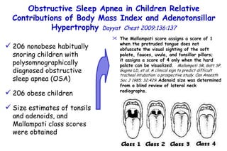 Obstructive Sleep Apnea in Children Relative Contributions of Body Mass Index and  Adenotonsillar Hypertrophy  Dayyat  Chest 2009;136:137 206 nonobese habitually snoring children with polysomnographically diagnosed obstructive sleep apnea (OSA)  206 obese children Size estimates of tonsils and adenoids, and Mallampati class scores were obtained The  Mallampati score assigns a score of 1 when the protruded tongue does not obfuscate the visual sighting of the soft palate, fauces, uvula, and tonsillar pillars;  it assigns a score of 4 only when the hard palate can be visualized.  Mallampati SR, Gatt SP, Gugino LD, et al. A clinical sign to  predict difficult tracheal intubation: a prospective study. Can  Anaesth Soc J 1985; 32:429 .   Adenoid size was determined from a blind review of lateral neck radiographs. 