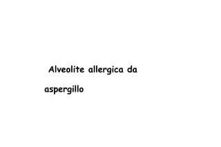 Alveolite allergica da aspergillo 