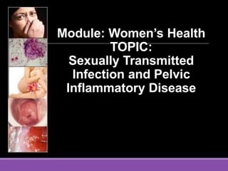 Module: Women’s Health
TOPIC:
Sexually Transmitted
Infection and Pelvic
Inflammatory Disease
 