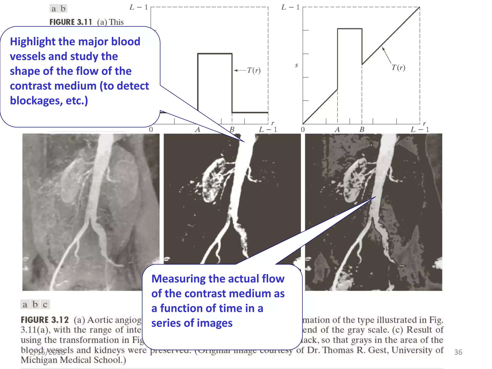 2/16/2018 36
Highlight the major blood
vessels and study the
shape of the flow of the
contrast medium (to detect
blockages, etc.)
Measuring the actual flow
of the contrast medium as
a function of time in a
series of images
 