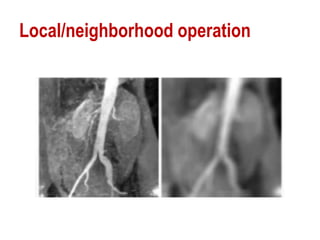 Local/neighborhood operation
 