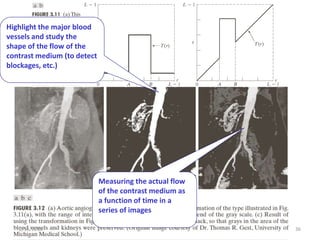 2/16/2018 36
Highlight the major blood
vessels and study the
shape of the flow of the
contrast medium (to detect
blockages, etc.)
Measuring the actual flow
of the contrast medium as
a function of time in a
series of images
 