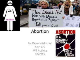 Abortion
By: Dejonia Mitchell
ANP 270
W5 Activity
10/2/15
 