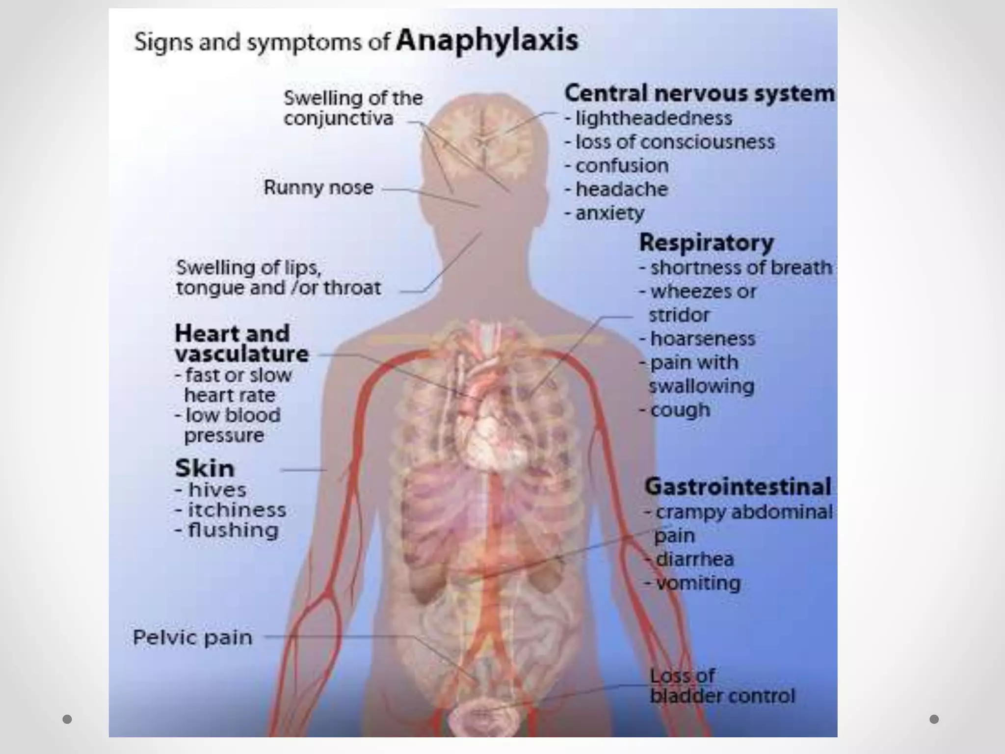 Anaphylaxis | PPTX